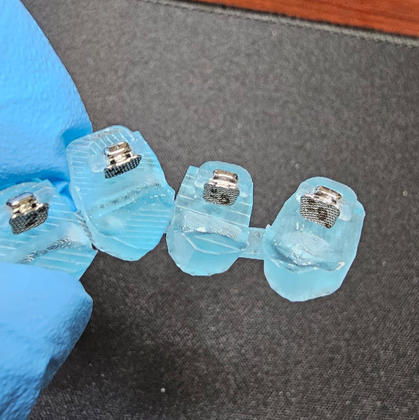 Custom Braces - as easy as clear aligners!