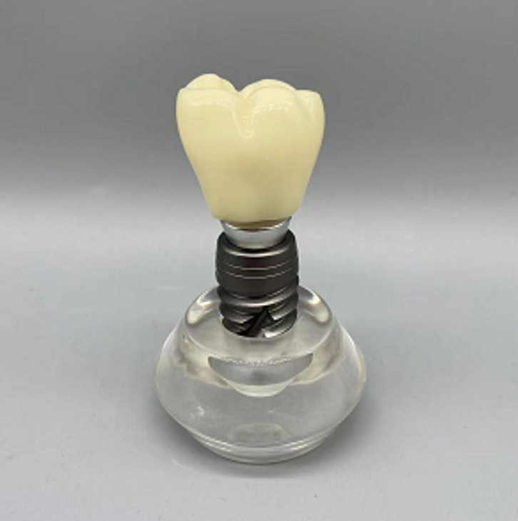 Dental Implant Educational Model