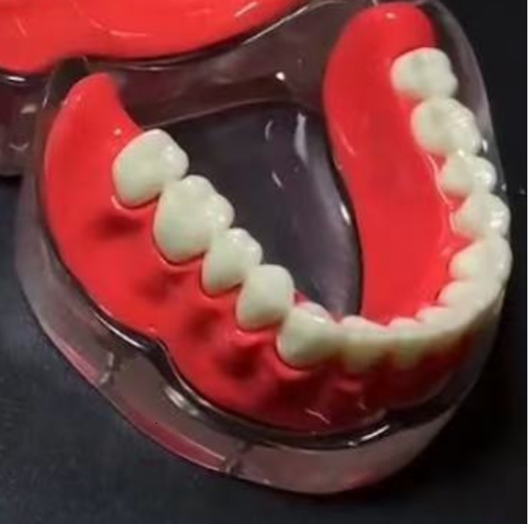 Full-Arch Implant Denture Educational Model – Upper or Lower