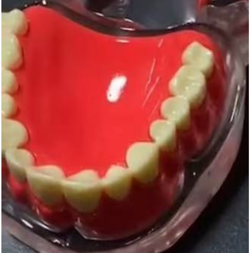 Full-Arch Implant Denture Educational Model – Upper or Lower
