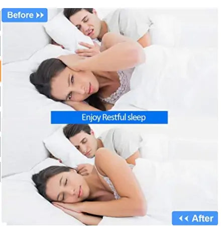 Premium Anti Snoring Device